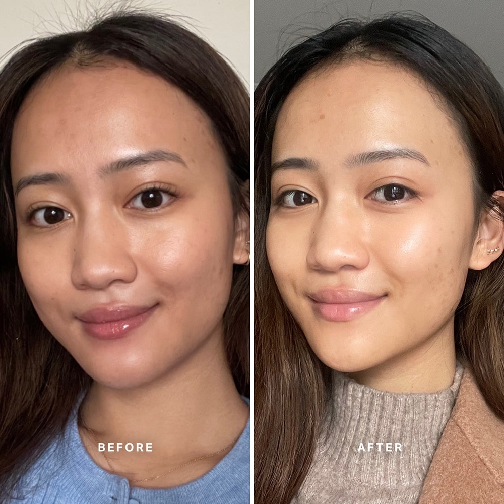 🆕️✨️Alpha-H Liquid Gold with Glycolic Acid - Picture 4 of 16